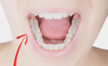 Zahnarzt, Praxis, Dr. Valeska Guth, Achern, Renchen, Appenweier, Rheinau, Önsbach, Mösbach, Sasbach, Fautenbach